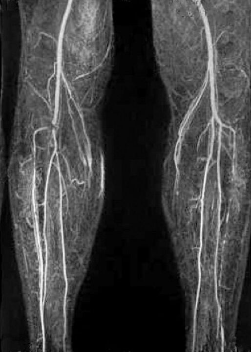 Vasculaire X -RAY