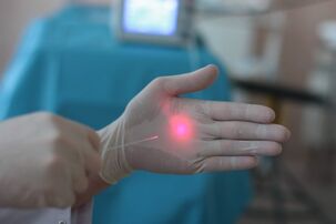 hoe u zich kunt voorbereiden op een laserbehandeling van spataderen