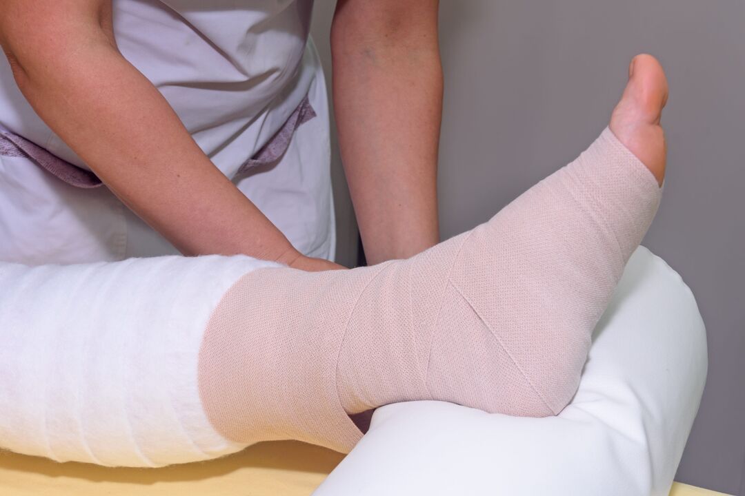 elastische bandages voor spataderen bij mannen